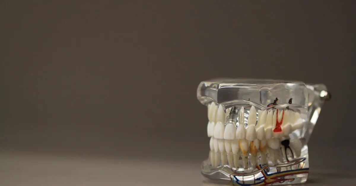 The Smartest Way to Shop Supersmile: Insider Tips + 2026 Codes